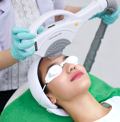 Photo Facial Acne