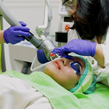 Laser Fractional CO2 Acne Scars