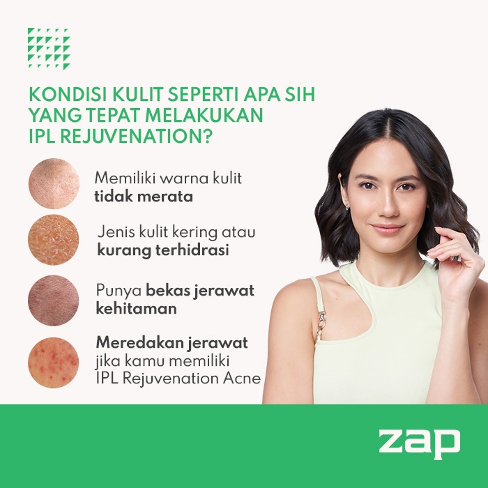 IPL Rejuvenation Double (250 shot) + Peeling Acne + Oxy Infusion
