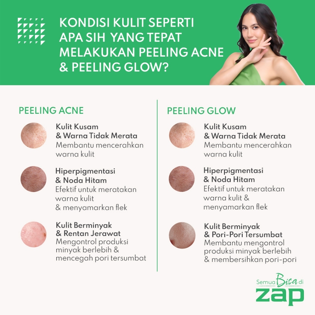 Facial Ekstraksi Essential (Acne) + IPL Rejuvenation Double Acne (250 shot) + Peeling Acne + Oxy Infusion Acne + Pharma Cream Acne + Juva by ZAP Pimple Punch 10ml