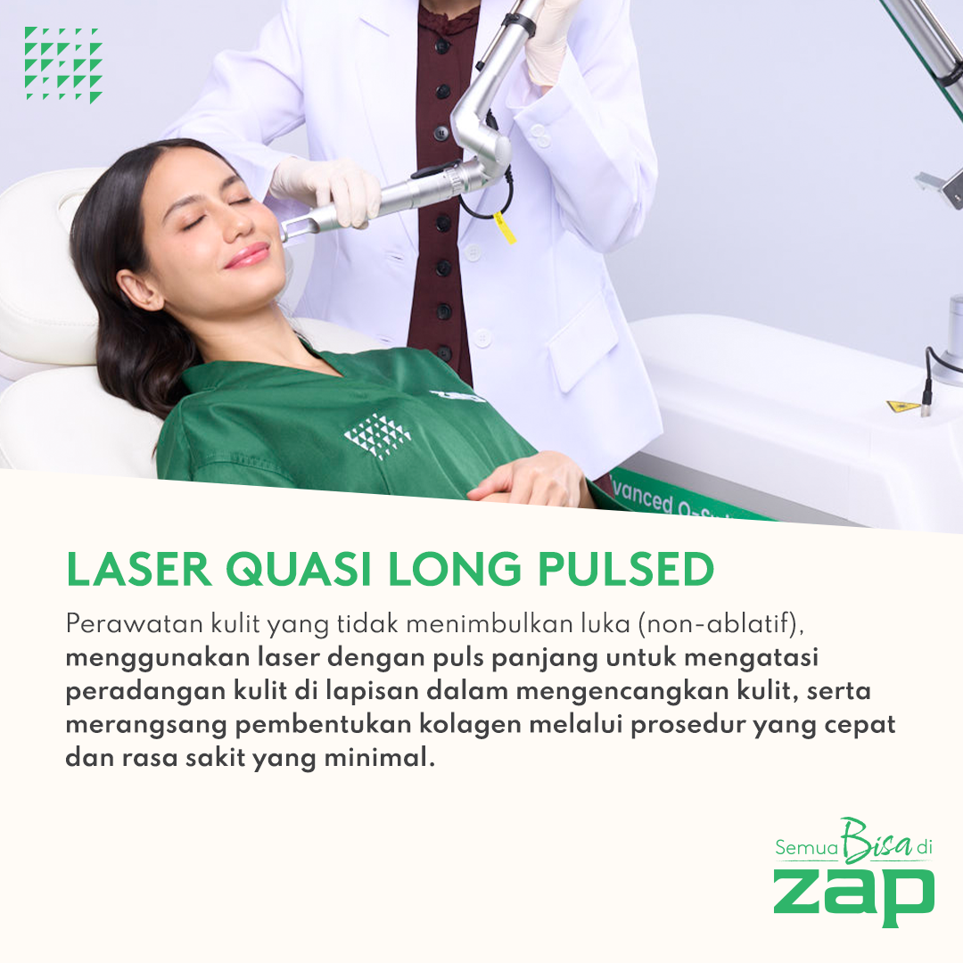Laser Quasi Long Pulsed ZAP