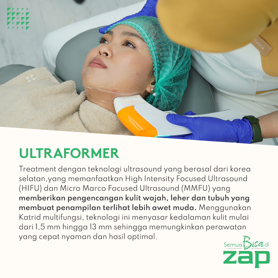 Ultraformer by Dermatologist 200 Shots ZAP