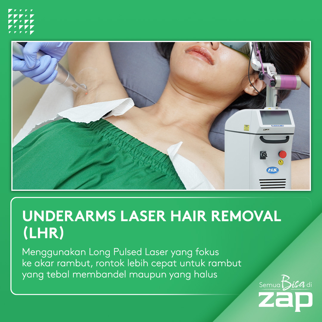 Underarm Laser Hair Removal - ZAP