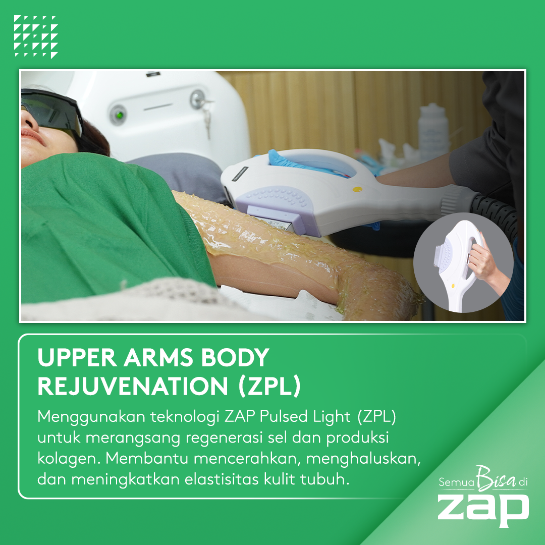 Upper Arms Rejuvenation - ZAP
