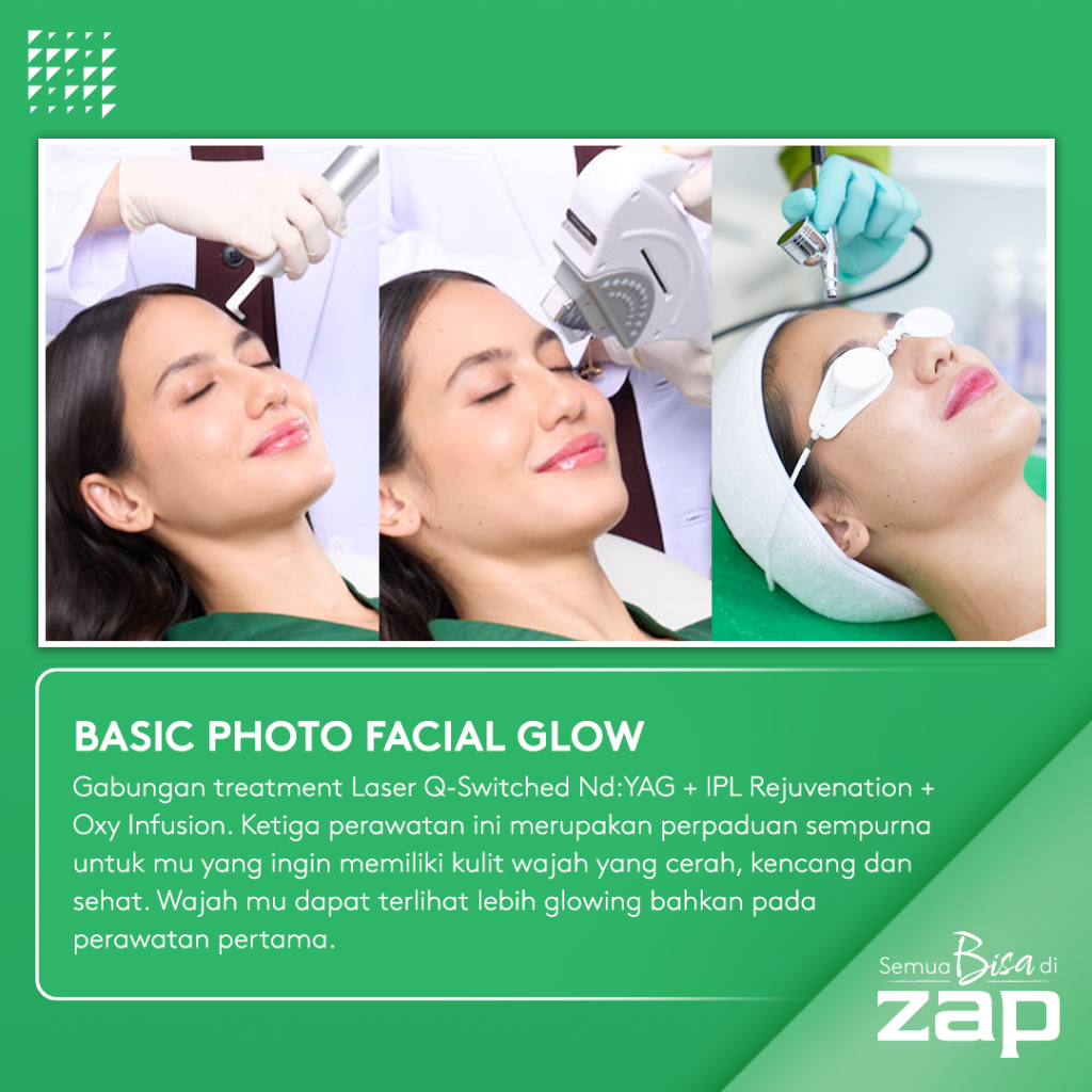 Basic Photo Facial Glow - Laser Q-Switched Nd:YAG (1000 shots) + IPL Rejuvenation (125 shot) + Oxy Infusion
