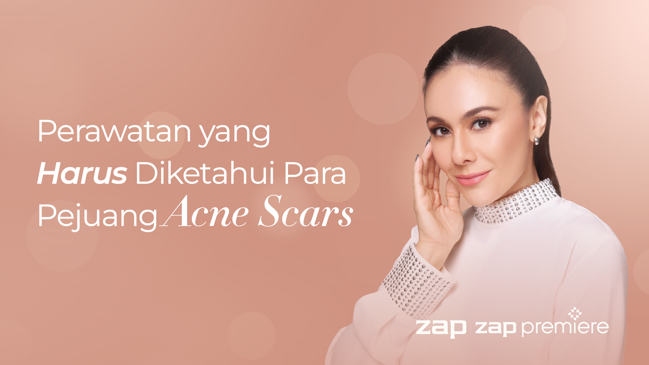Perawatan yang Harus Diketahui Para Pejuang Acne Scars