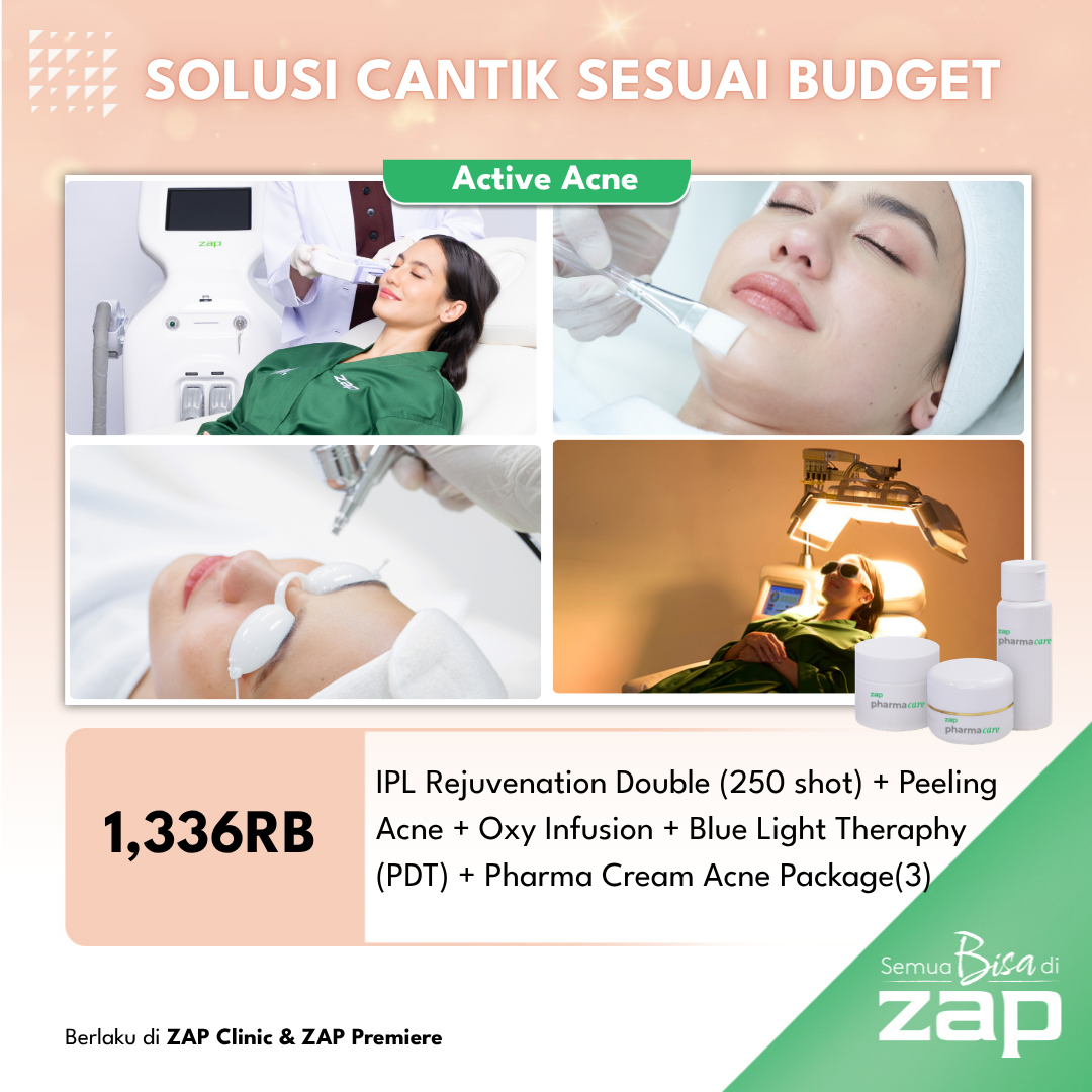 IPL Rejuvenation Double (250 shot) + Peeling Acne + Oxy Infusion + Blue Light Theraphy (PDT) + Pharmacy Cream Acne Package