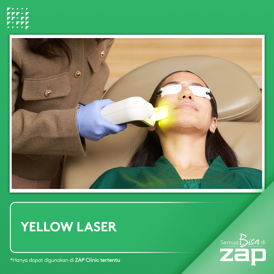 FIRST TRIAL Pro Yellow