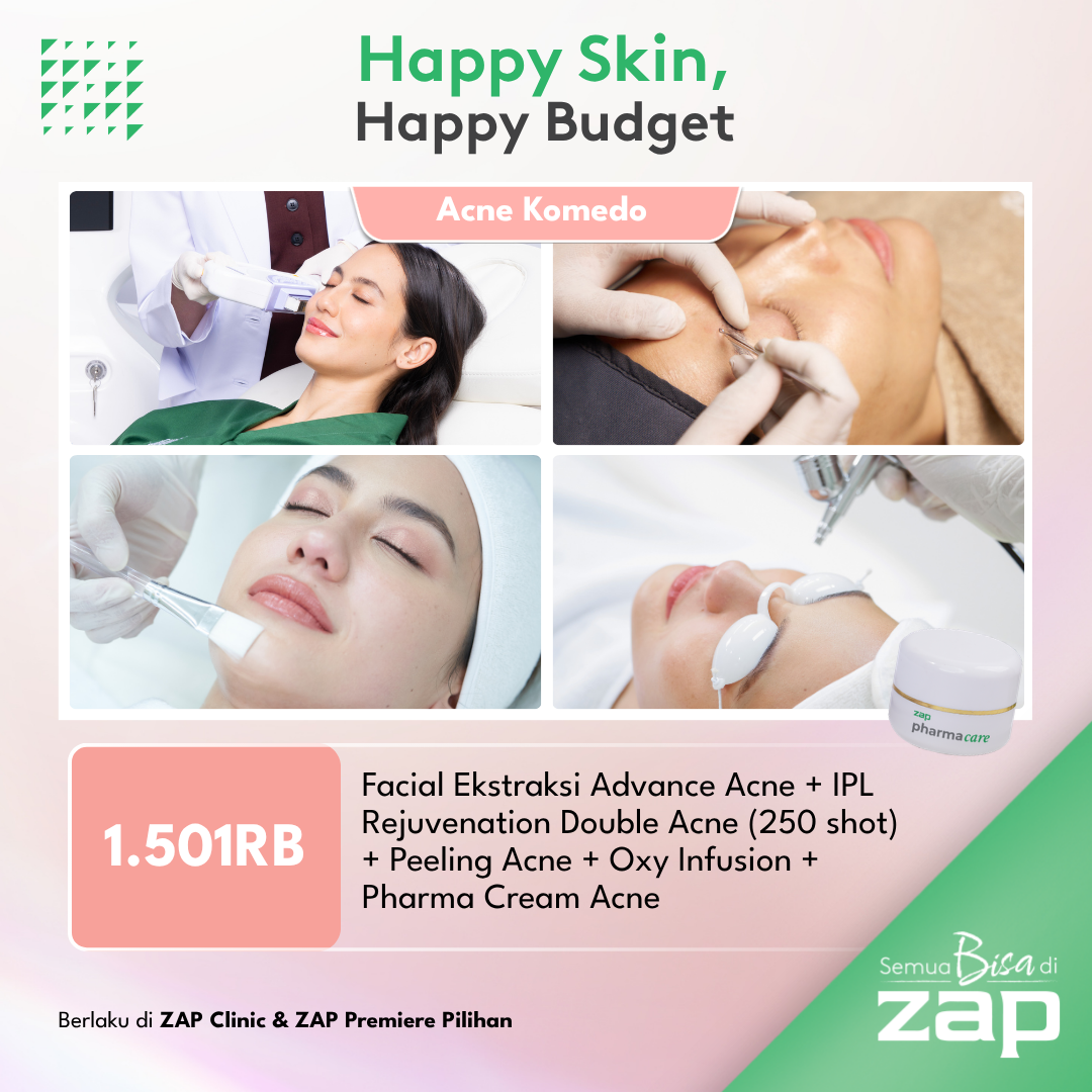 Facial Ekstraksi Advance Acne + IPL Rejuvenation Double Acne (250 shot) + Peeling Acne + Oxy Infusion + Pharma Cream Acne